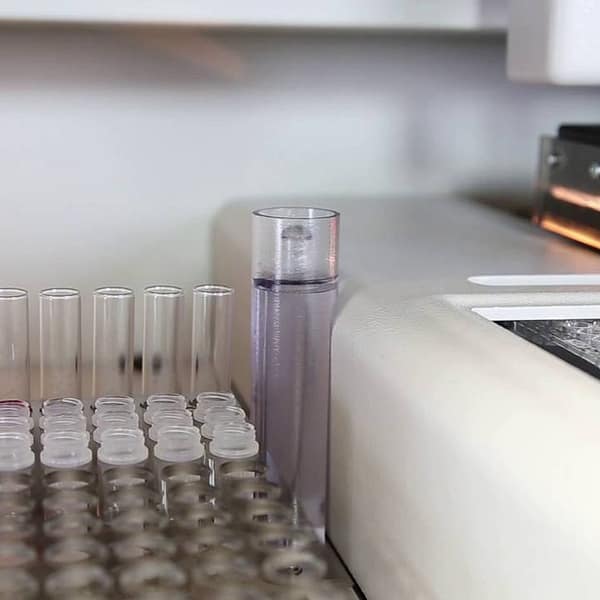 Máy xét nghiệm miễn dịch tự động