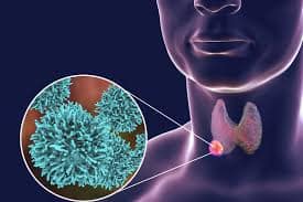 Kit Elisa cho tuyến giáp